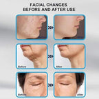 Derma Stamp 140A Micro Needling Tool For Hair, Skin And Acne - Khareedlo.com.pk