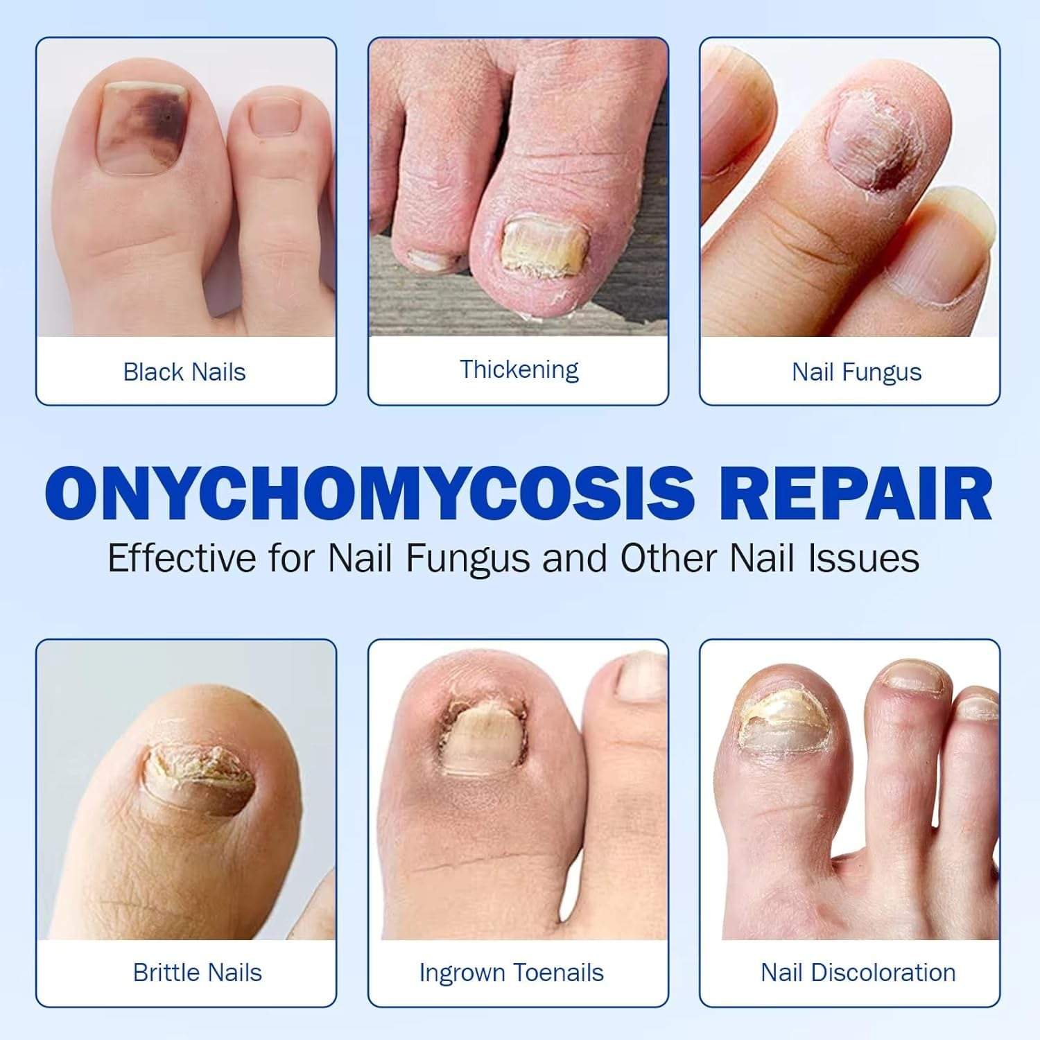 Night Time Renewal Fungal Nail Patches