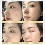 Chalonese Brightening Cream - Khareedlo.com.pk