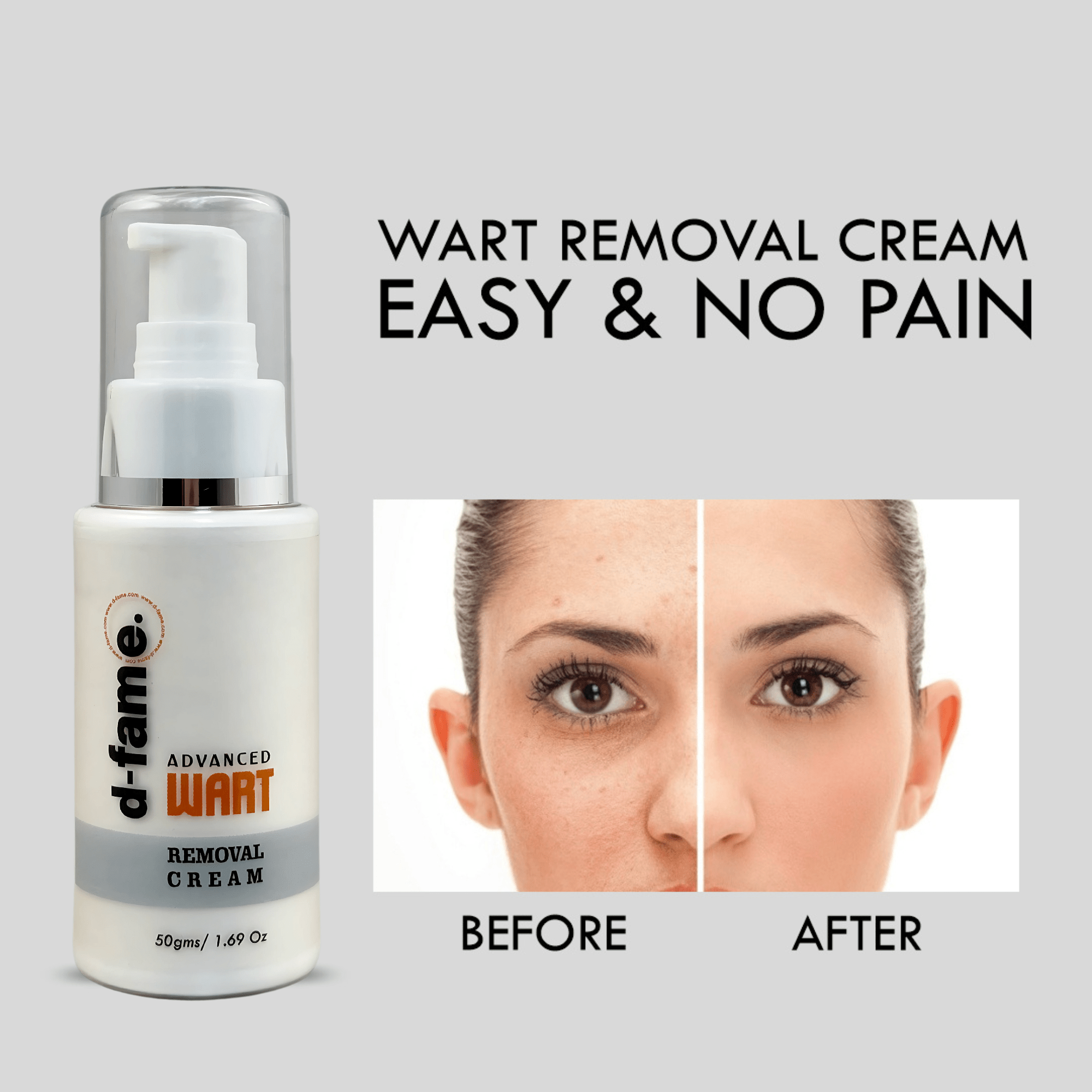 D-Fame Advanced Wart Removal Cream – Fast Results