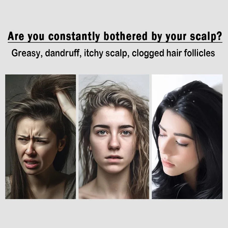 Anti-Dandruff Hollow Massage Hairbrush - Khareedlo.com.pk