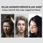 Anti-Dandruff Hollow Massage Hairbrush - Khareedlo.com.pk