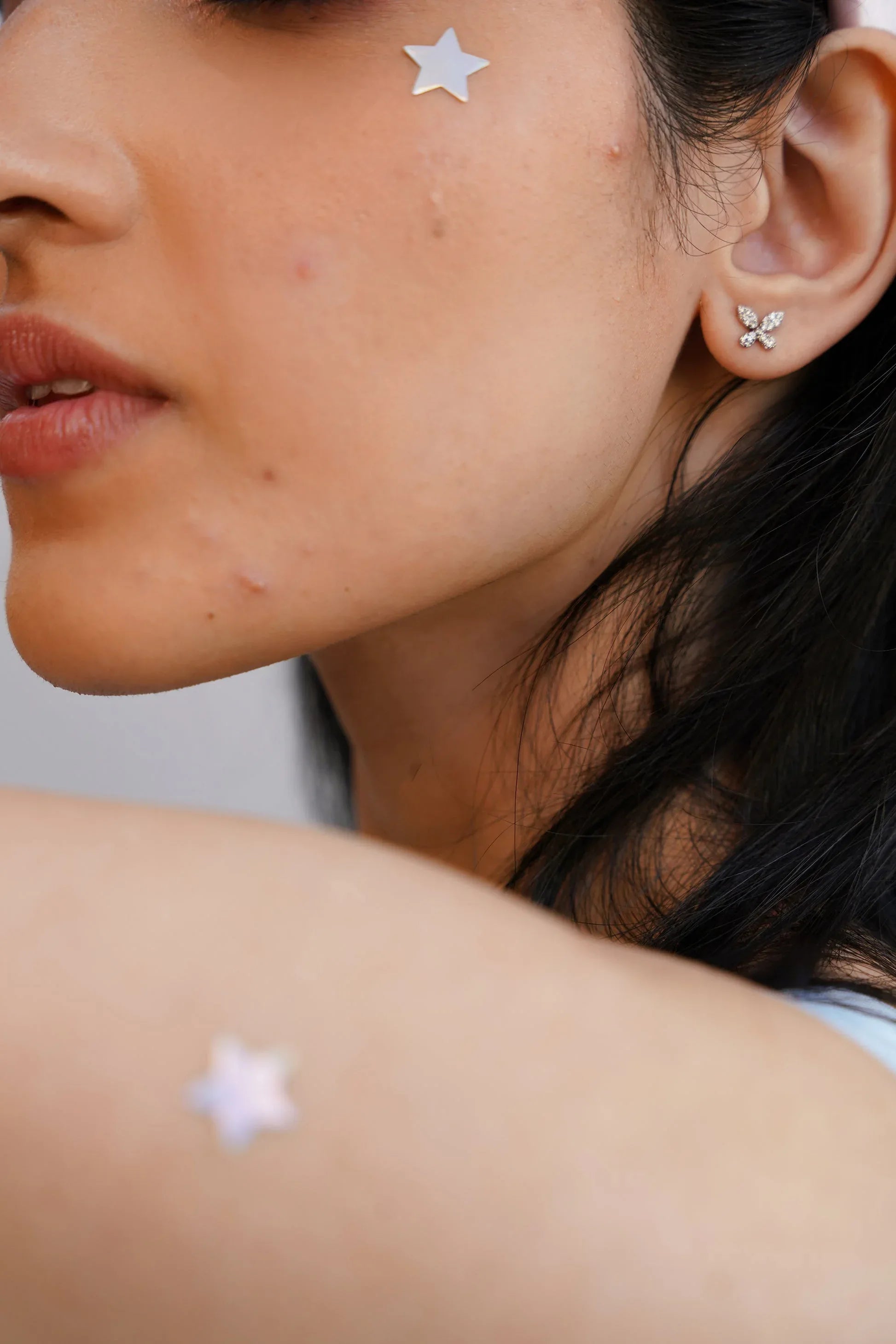 Acne Party Patches PACK OF 20 - Khareedlo.com.pk