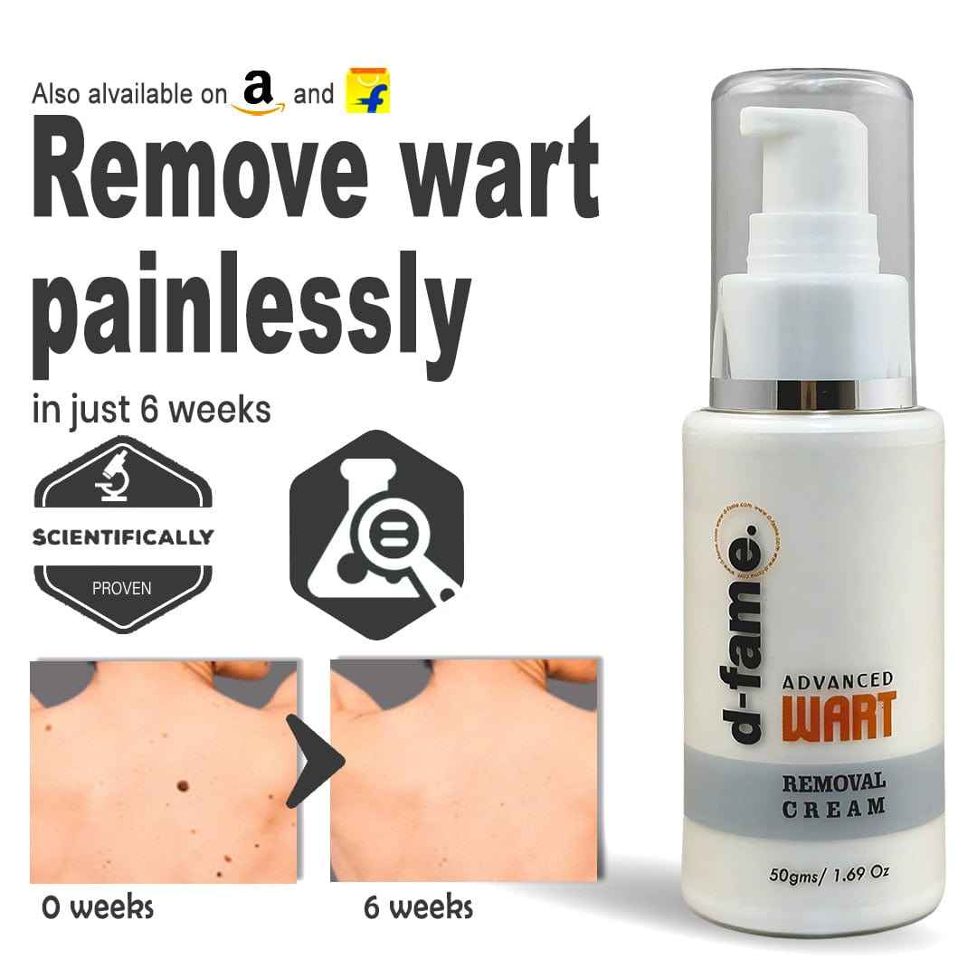 D-Fame Advanced Wart Removal Cream – Fast Results